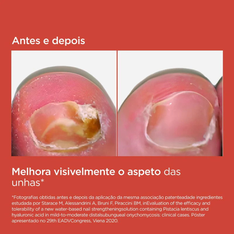 ISDIN Si-Nails Micoexpert Ação Antifúngica 4,5ml - Image 2