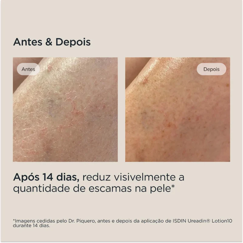 ISDIN Ureadin Loção 10 Hidratação Intensa 400ml - Image 7