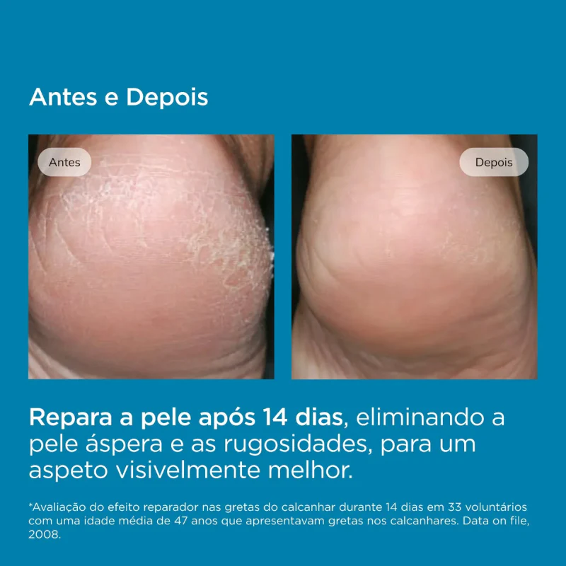 ISDIN Ureadin Podos Gel Óleo 75ml - Image 6