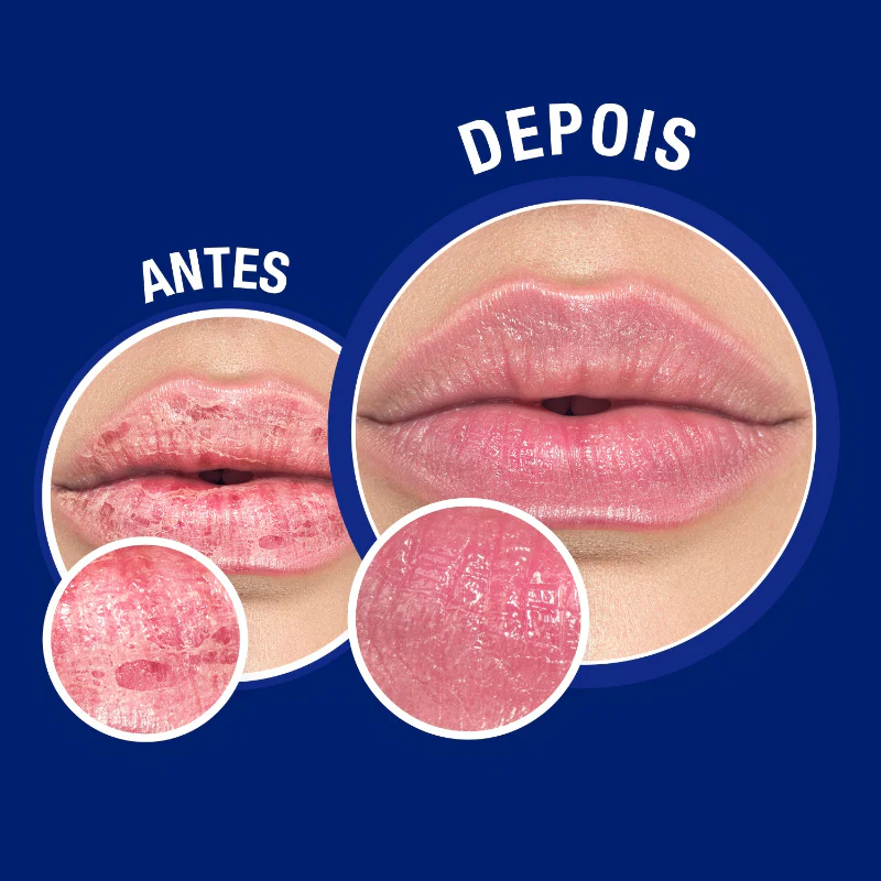 Neutrogena Bálsamo Reparação Imediata Nariz e Lábios 15ml - Image 5