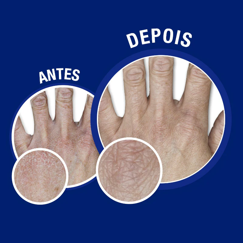 Neutrogena Creme Mãos e Unhas 75ml - Image 5